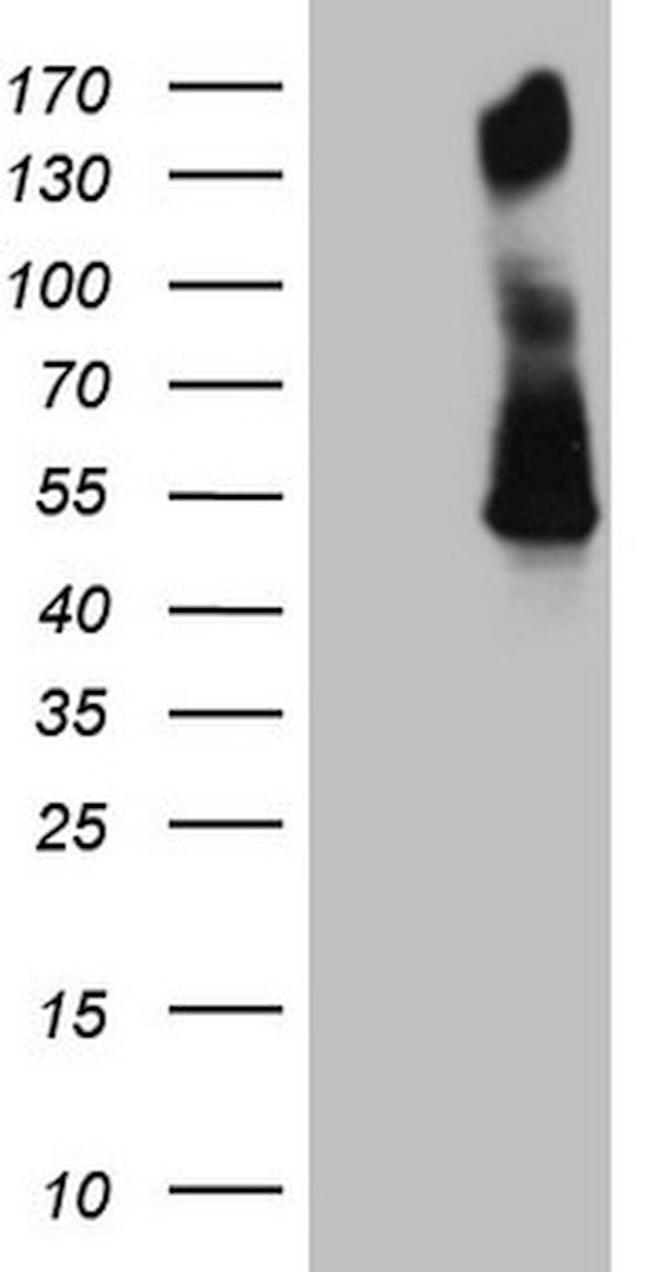 PD-L2 (PDCD1LG2) Antibody in Western Blot (WB)