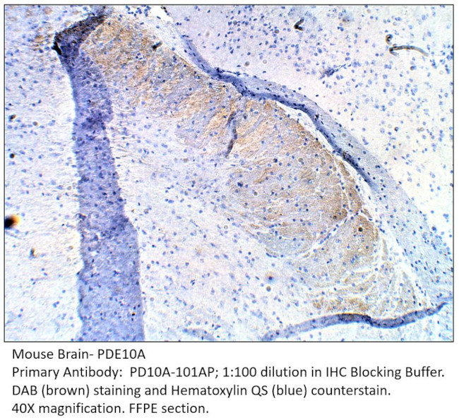 PDE10A Antibody in Immunohistochemistry (IHC)