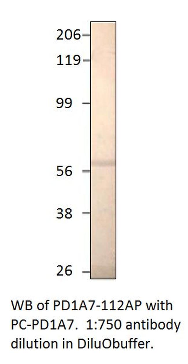PDE1A7 Antibody in Western Blot (WB)