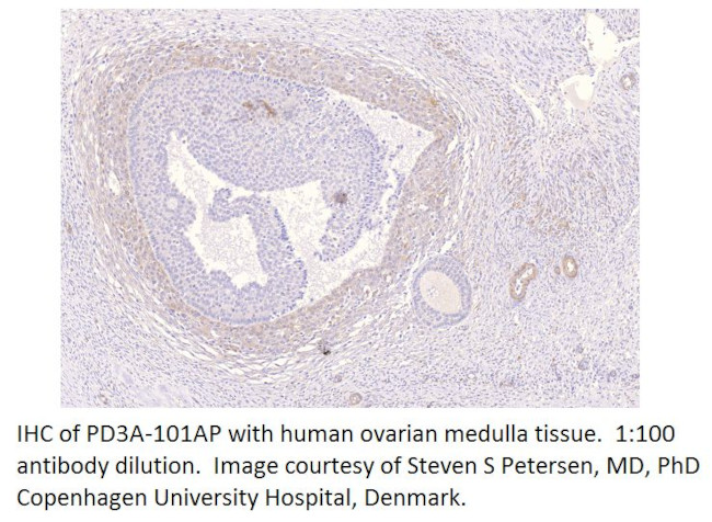 PDE3A Antibody in Immunohistochemistry (IHC)