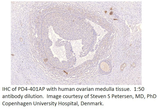 PDE4D Antibody in Immunohistochemistry (IHC)