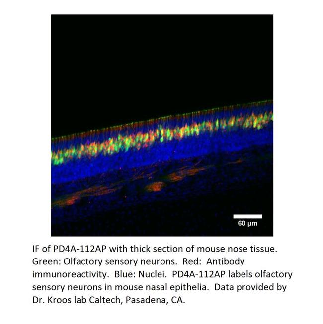 PDE4A Antibody in Immunohistochemistry (IHC)