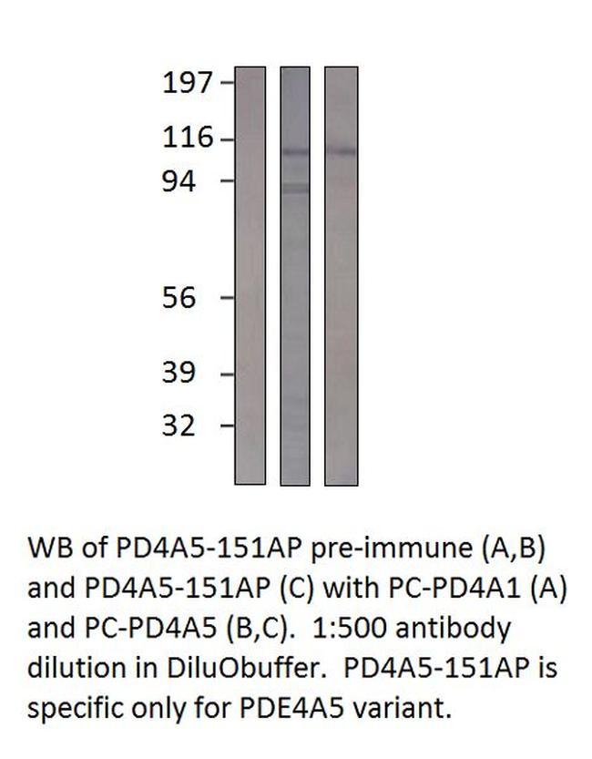 PDE4A5 Antibody in Western Blot (WB)