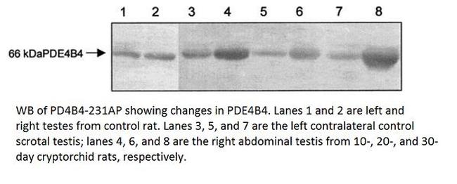 PDE4B4 Antibody in Western Blot (WB)