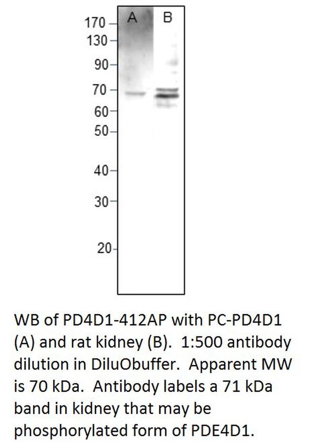 PDE4D1 Antibody in Western Blot (WB)