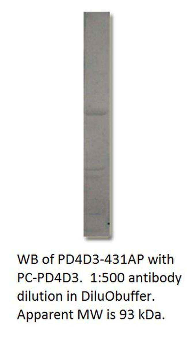 PDE4D3 Antibody in Western Blot (WB)