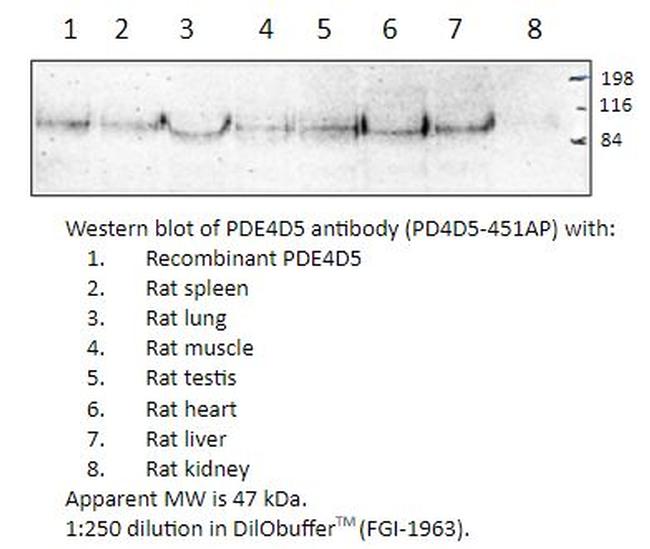 PDE4D5 Antibody in Western Blot (WB)
