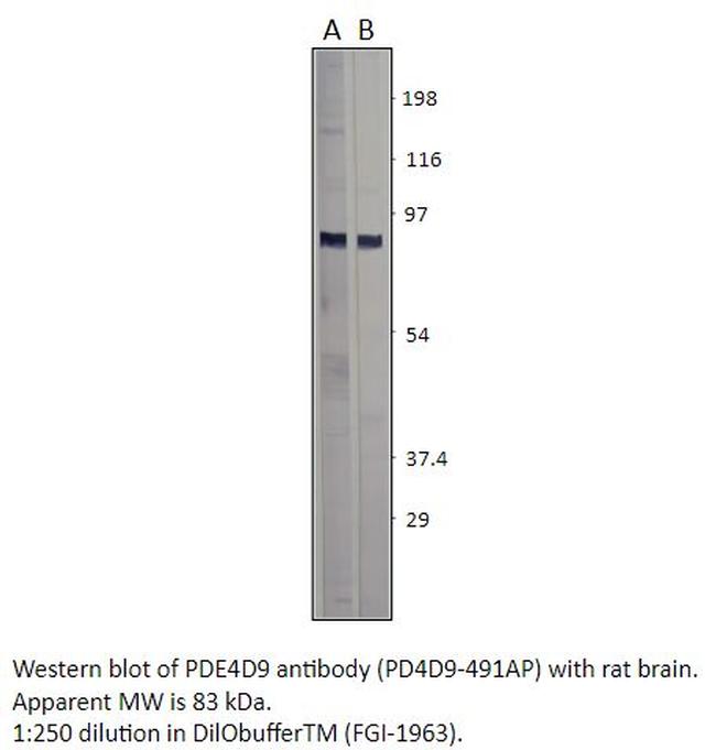 PDE4D9 Antibody in Western Blot (WB)
