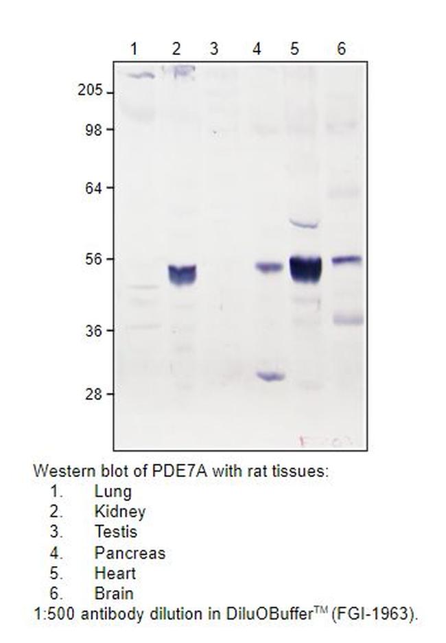 PDE7A Antibody in Western Blot (WB)