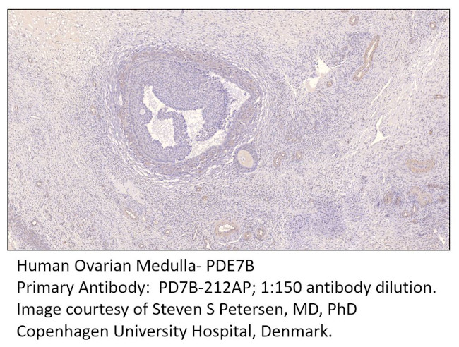 PDE7B Antibody in Immunohistochemistry (IHC)