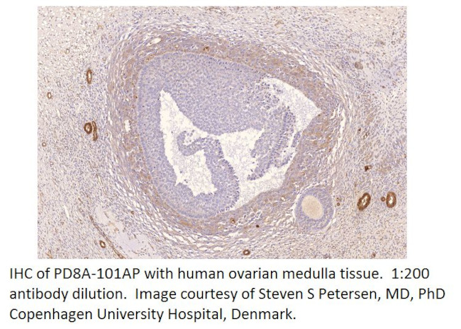 PDE8A Antibody in Immunohistochemistry (IHC)