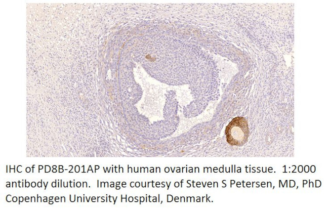 PDE8B Antibody in Immunohistochemistry (IHC)