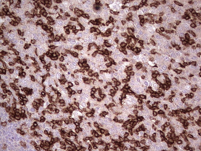 PDCD1 Antibody in Immunohistochemistry (Paraffin) (IHC (P))