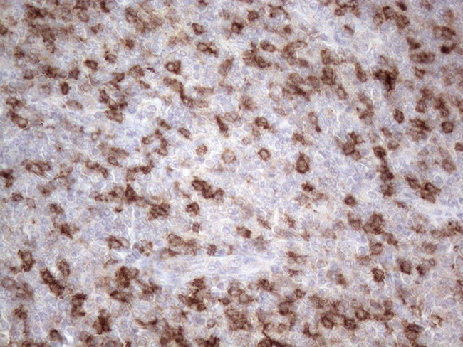 PDCD1 Antibody in Immunohistochemistry (Paraffin) (IHC (P))