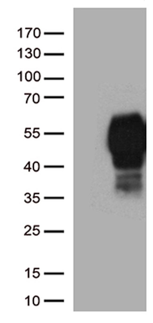 PDCD1 Antibody in Western Blot (WB)