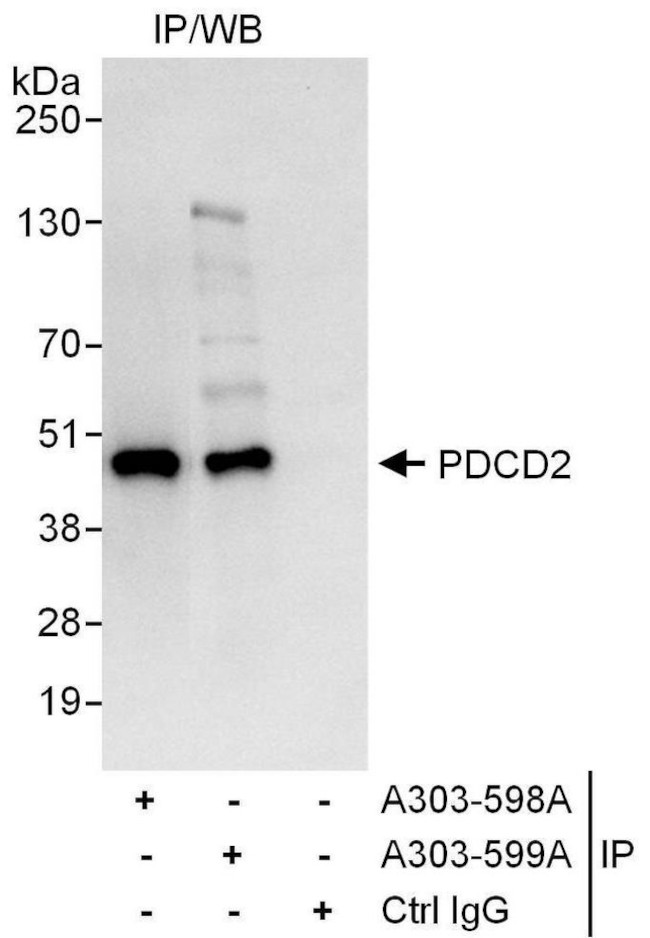 PDCD2 Antibody in Immunoprecipitation (IP)
