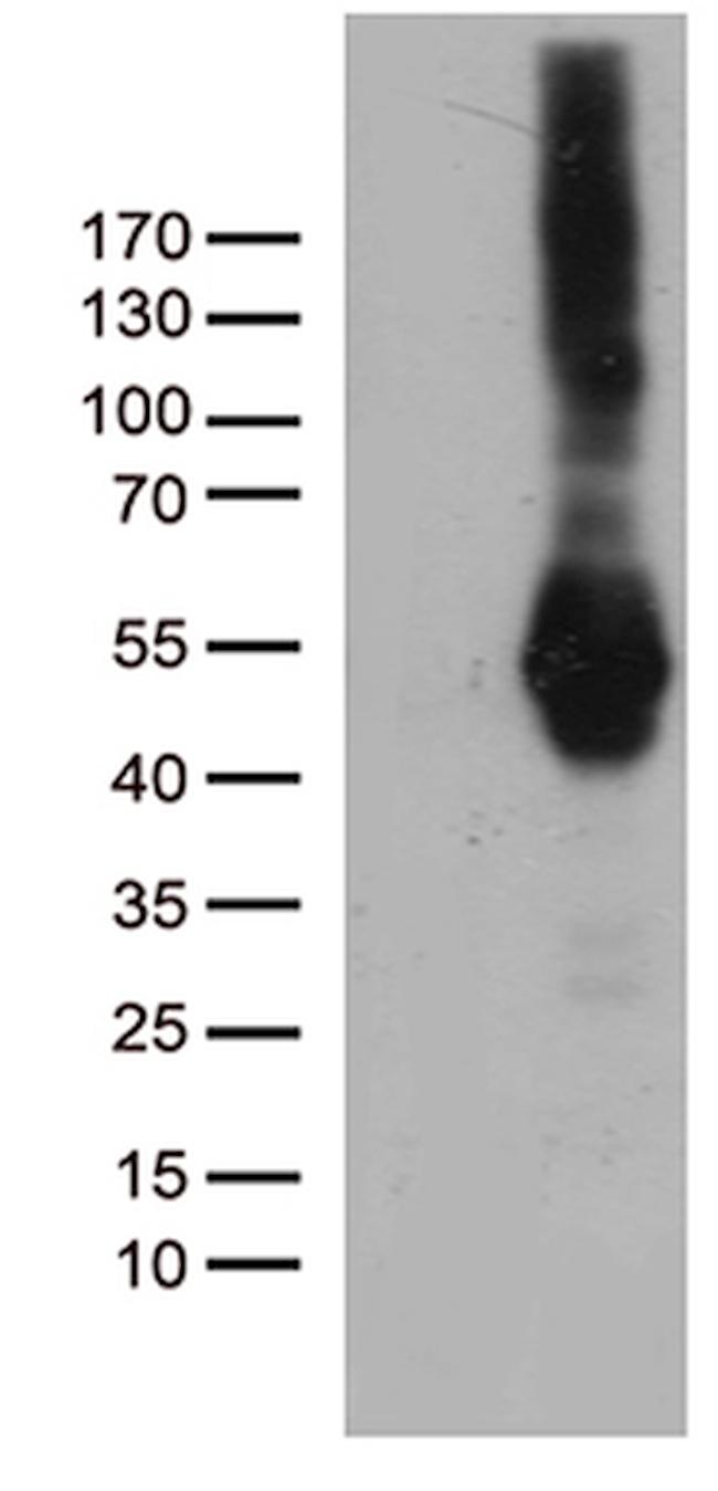 PDCD2L Antibody in Western Blot (WB)