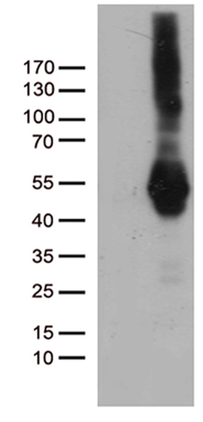 PDCD2L Antibody in Western Blot (WB)