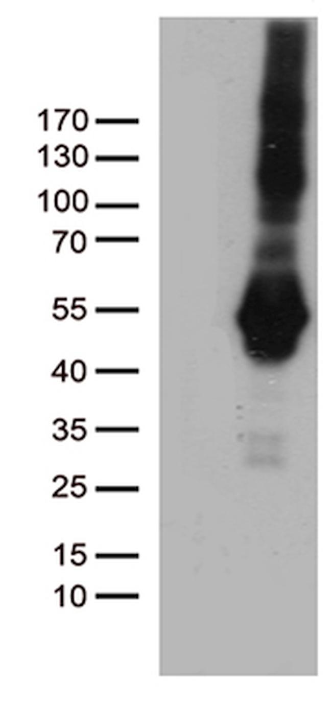 PDCD2L Antibody in Western Blot (WB)