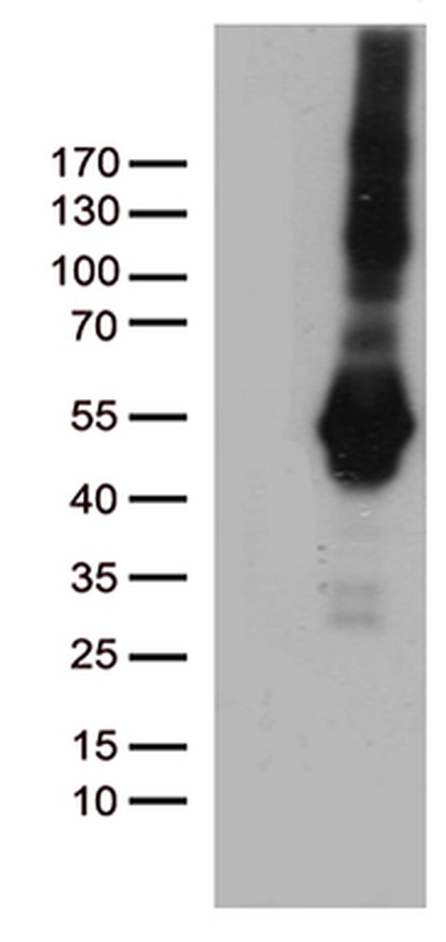 PDCD2L Antibody in Western Blot (WB)