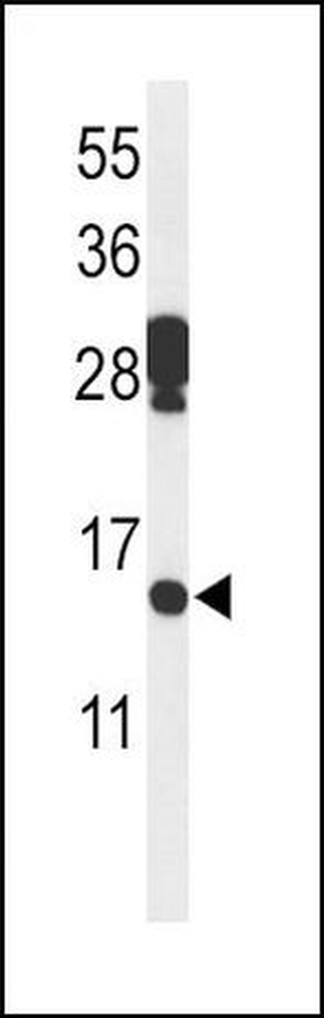 PDCD5 Antibody in Western Blot (WB)