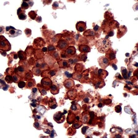PDCD6 Antibody in Immunohistochemistry (IHC)
