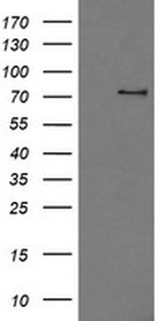 PDE10A Antibody in Western Blot (WB)