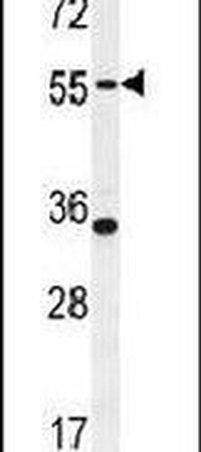 PDE12 Antibody in Western Blot (WB)