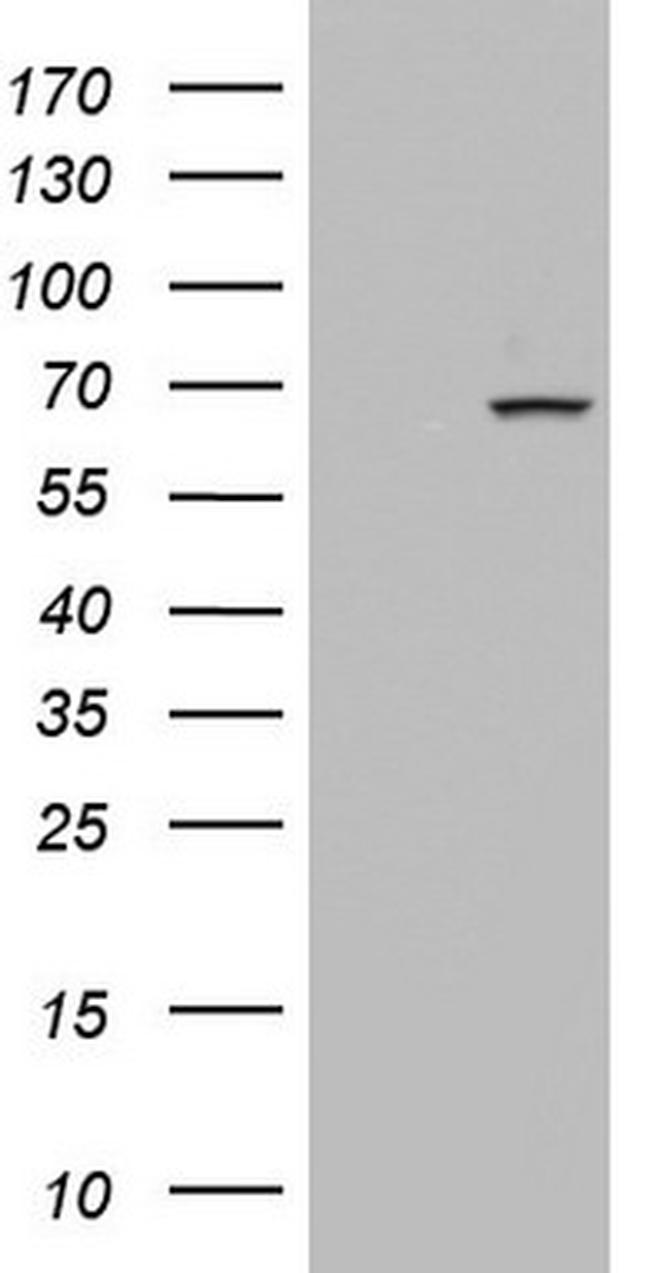 PDE1A Antibody in Western Blot (WB)