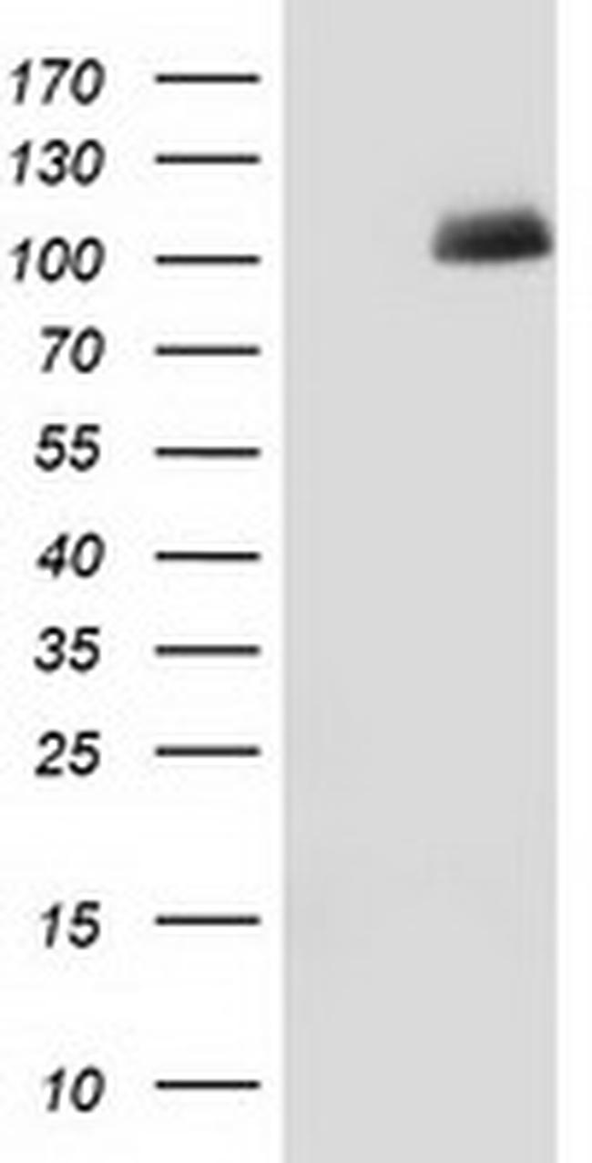 PDE2A Antibody in Western Blot (WB)