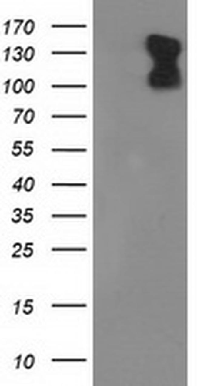 PDE2A Antibody in Western Blot (WB)