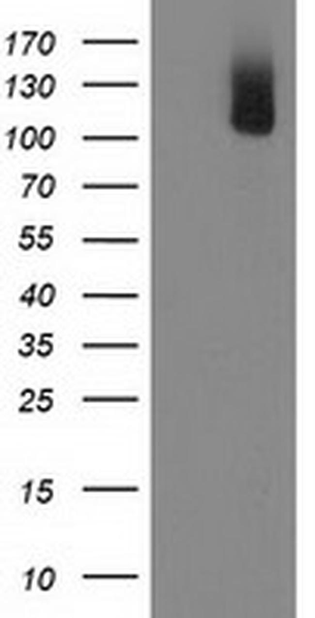 PDE2A Antibody in Western Blot (WB)