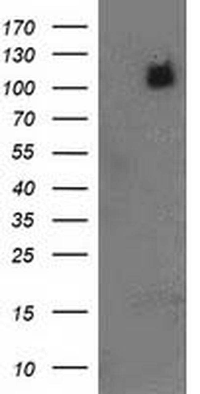 PDE2A Antibody in Western Blot (WB)