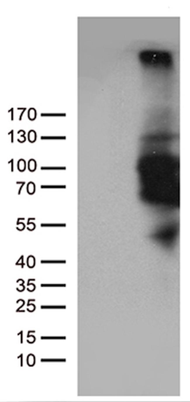 PDE3B Antibody in Western Blot (WB)