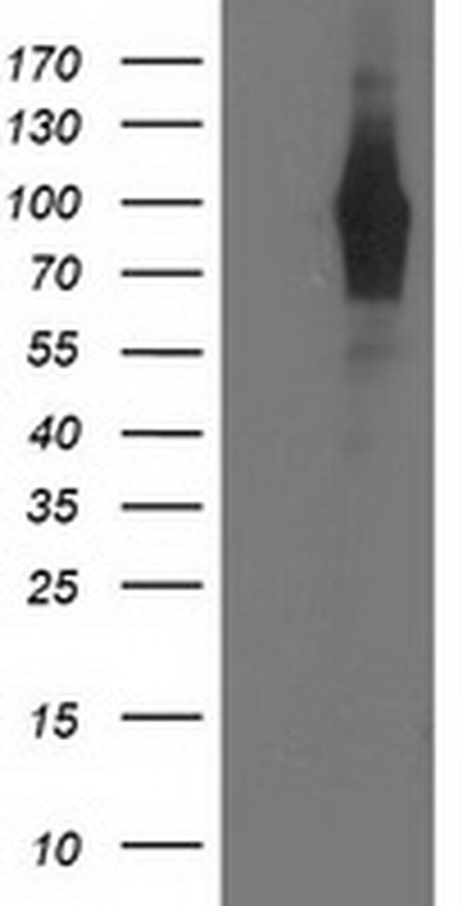 PDE4B Antibody in Western Blot (WB)