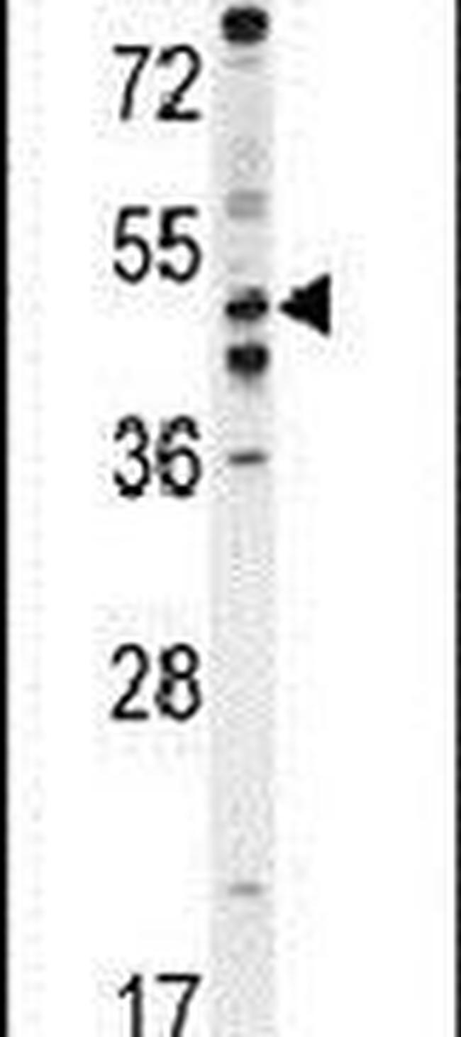 PDE7B Antibody in Western Blot (WB)