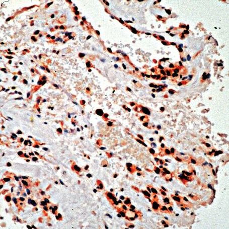 PDGFRA Antibody in Immunohistochemistry (IHC)