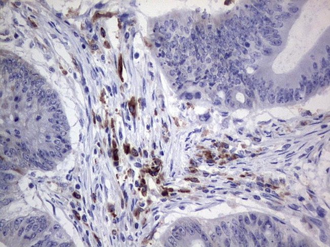 PDGFRA Antibody in Immunohistochemistry (Paraffin) (IHC (P))