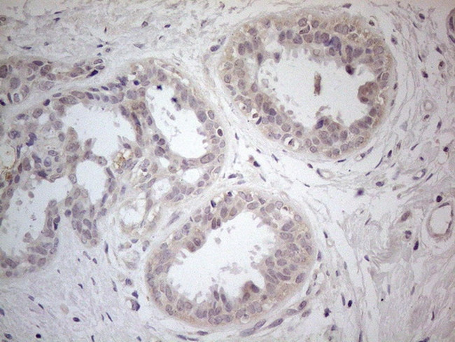 PDGFRA Antibody in Immunohistochemistry (Paraffin) (IHC (P))