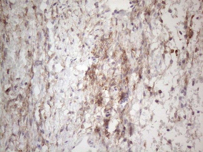 PDGFRA Antibody in Immunohistochemistry (Paraffin) (IHC (P))