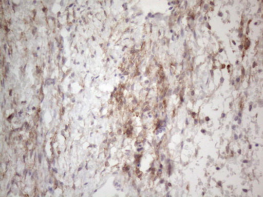 PDGFRA Antibody in Immunohistochemistry (Paraffin) (IHC (P))