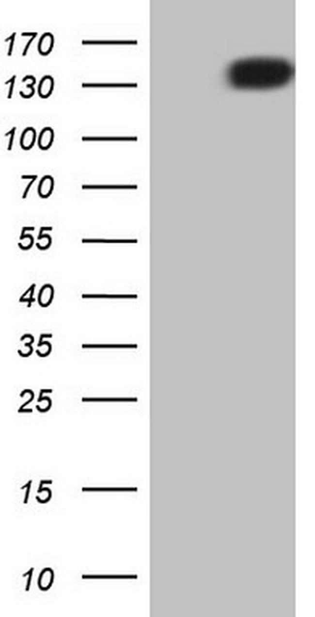 PDGFRA Antibody in Western Blot (WB)