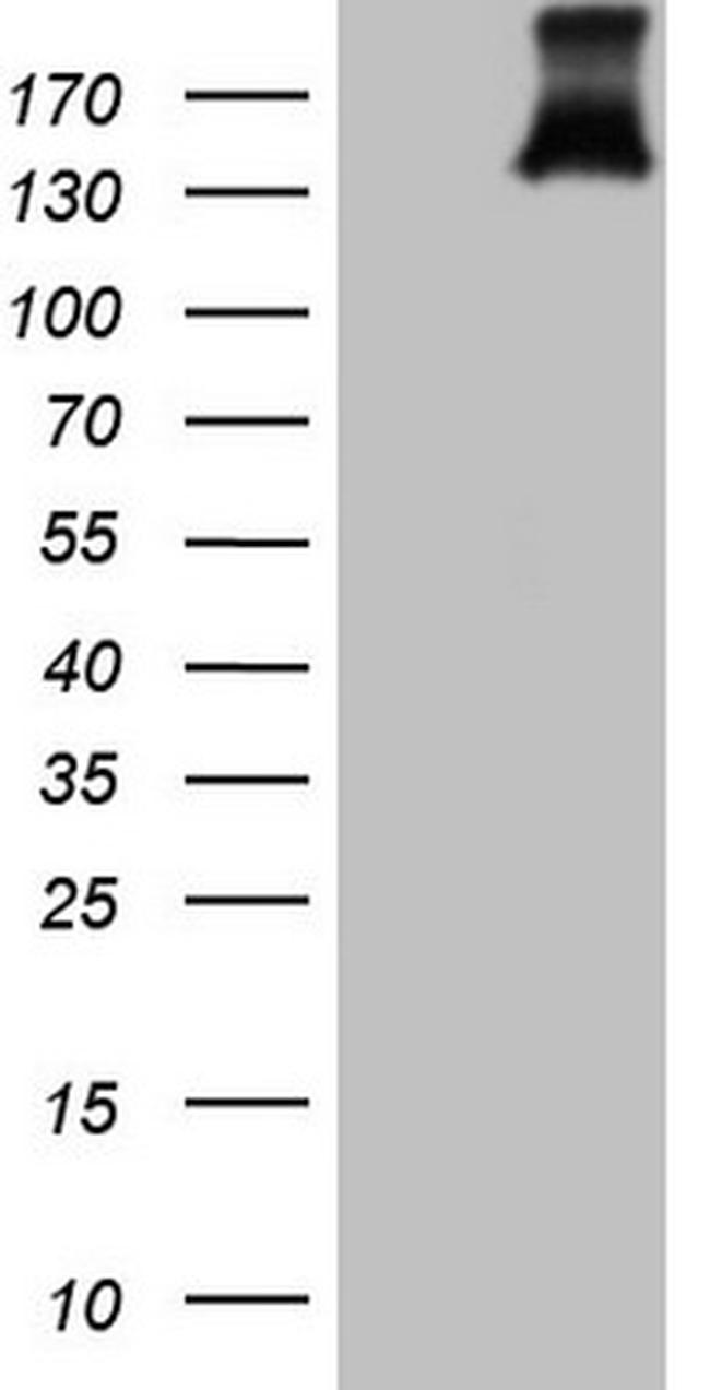 PDGFRA Antibody in Western Blot (WB)
