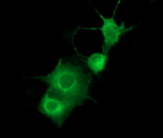 PDGFRB Antibody in Immunocytochemistry (ICC/IF)