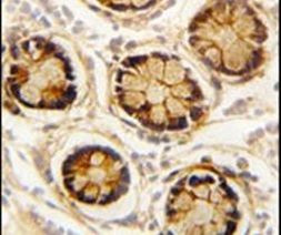 PDGFRL Antibody in Immunohistochemistry (IHC)