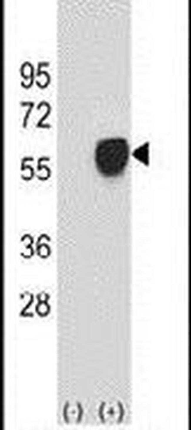 PDHA1 Antibody in Western Blot (WB)