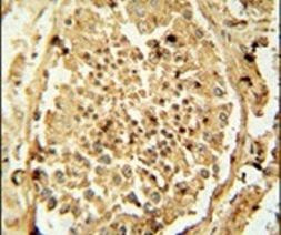 PDHA2 Antibody in Immunohistochemistry (IHC)