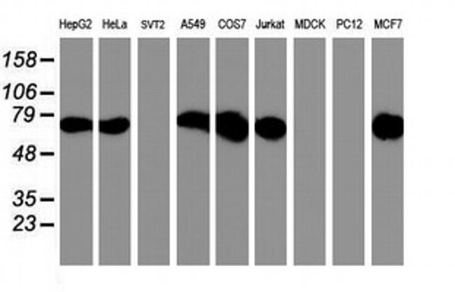 PDIA4 Antibody in Western Blot (WB)