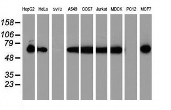 PDIA4 Antibody in Western Blot (WB)