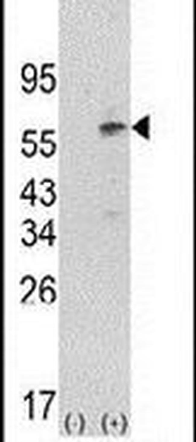 PDPK1 Antibody in Western Blot (WB)